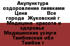 Акупунктура, оздоровление пиявками › Цена ­ 3 000 - Все города, Жуковский г. Медицина, красота и здоровье » Медицинские услуги   . Тамбовская обл.,Тамбов г.